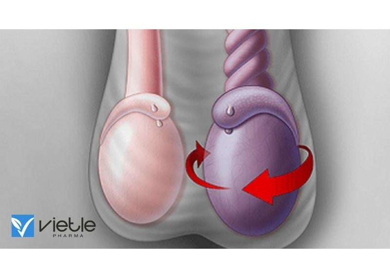 XOẮN TINH HOÀN VÀ NHỮNG ĐIỀU CẦN BIẾT