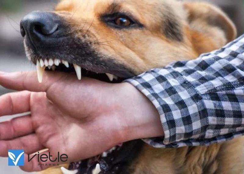 XỬ TRÍ VẾT THƯƠNG DO NGƯỜI VÀ SÚC VẬT CẮN