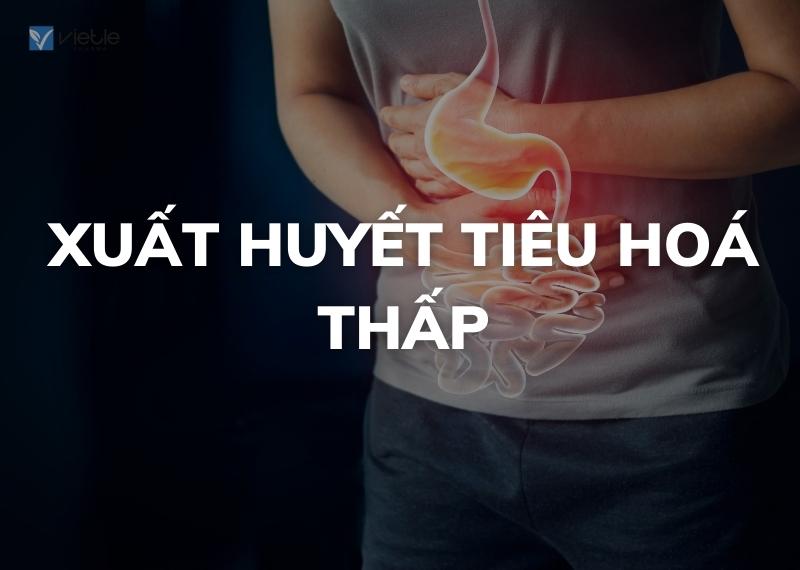 XUẤT HUYẾT TIÊU HOÁ THẤP - CHẨN ĐOÁN VÀ ĐIỀU TRỊ
