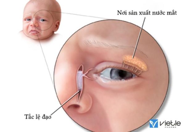 tắc lệ đạo