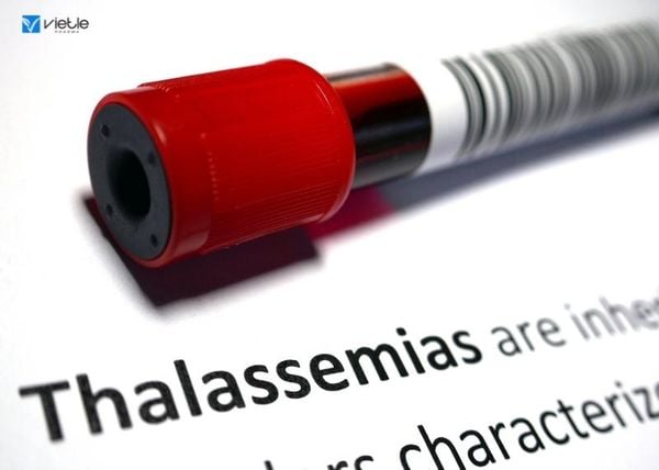 bệnh thalassemia