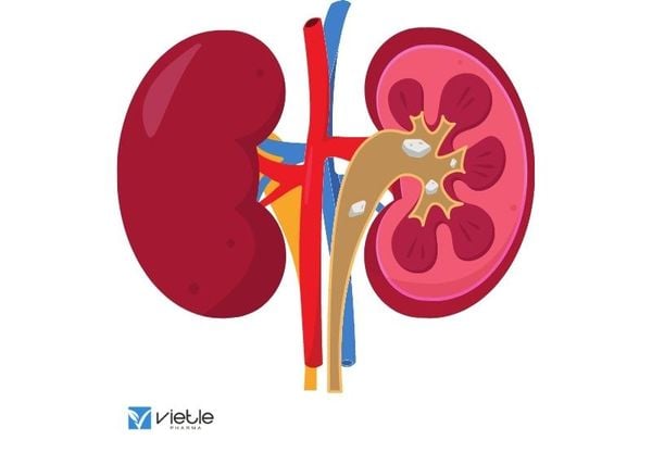 Bệnh thận đái tháo đường