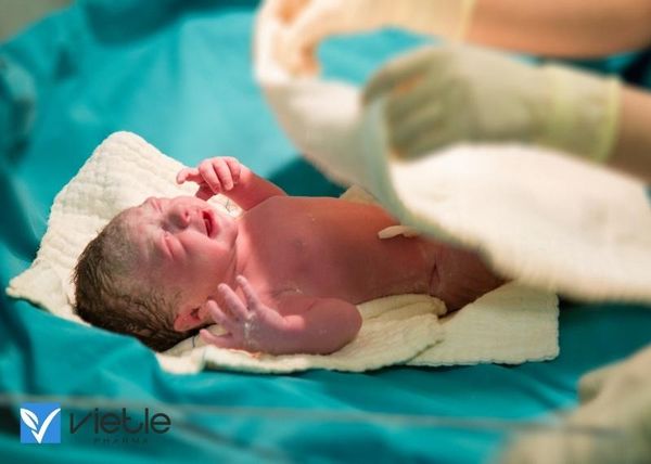 còn ống động mạch chủ ở trẻ đẻ non được hiểu như thế nào?