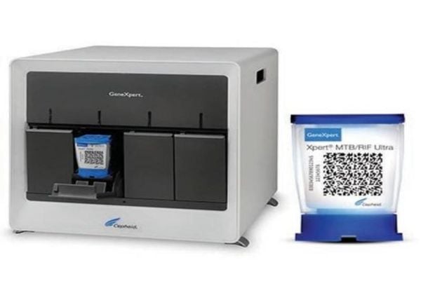 Đột phá xét nghiệm lao và lao đa kháng bằng kỹ thuật gene xpert