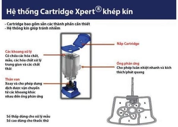 Đột phá xét nghiệm lao và lao đa kháng bằng kỹ thuật gene xpert