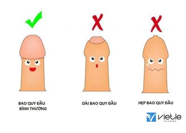 hẹp bao quy đầu
