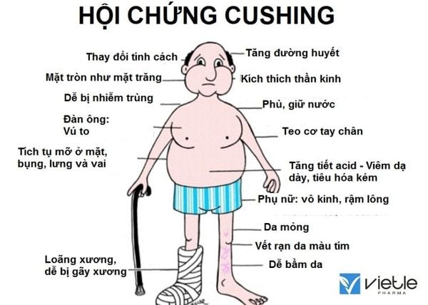 hội chứng cushing và những điều bạn cần lưu ý