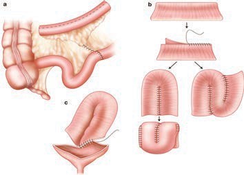 khoa niệu học chức năng