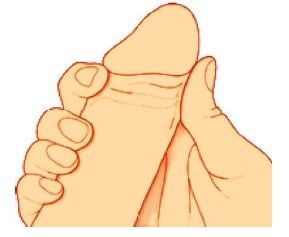 Kỹ thuật “bấm qui đầu”