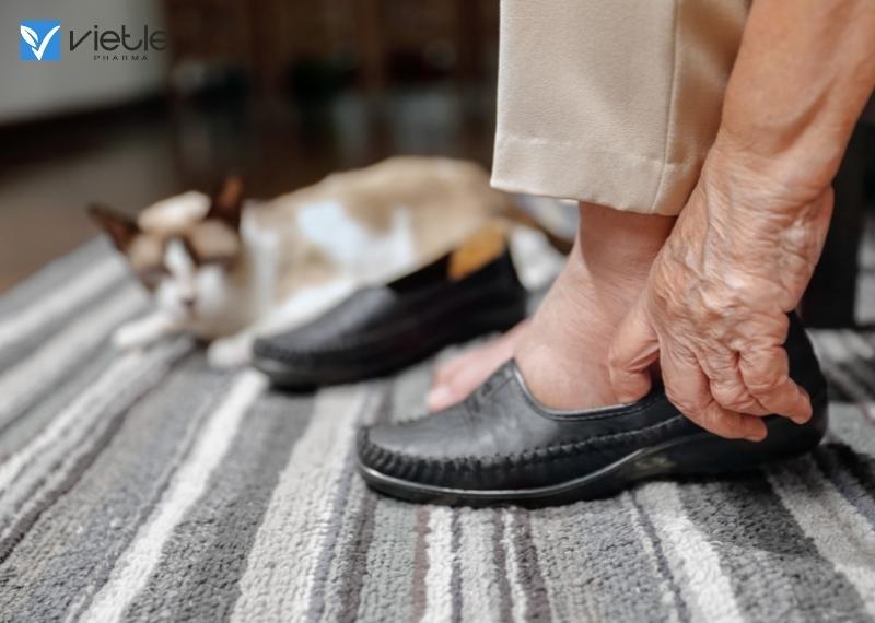 hội chứng sudeck ở người già