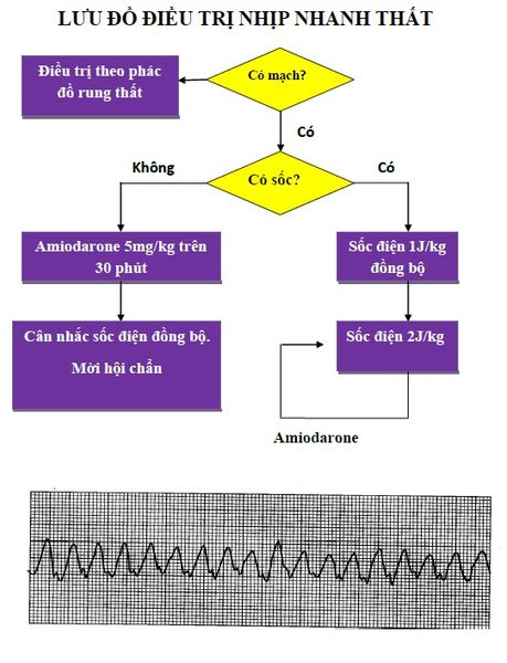 LƯU ĐỒ ĐIỀU TRỊ NHỊP NHANH TRÊN THẤT