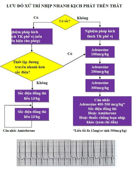 LƯU ĐỒ XỬ TRÍ NHỊP NHANH KỊCH PHÁT TRÊN THẤT