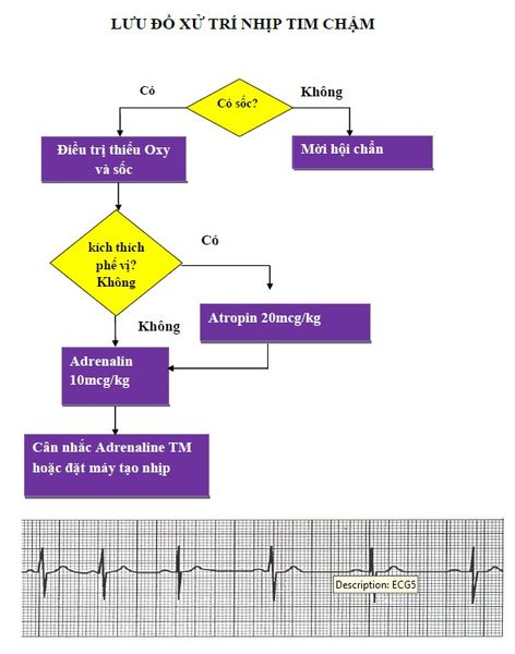 LƯU ĐỒ XỬ TRÍ NHỊP TIM CHẬM