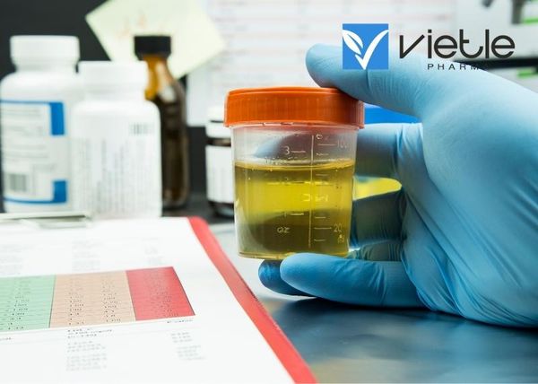 Protein niệu