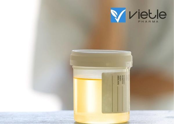 Protein niệu thai kỳ