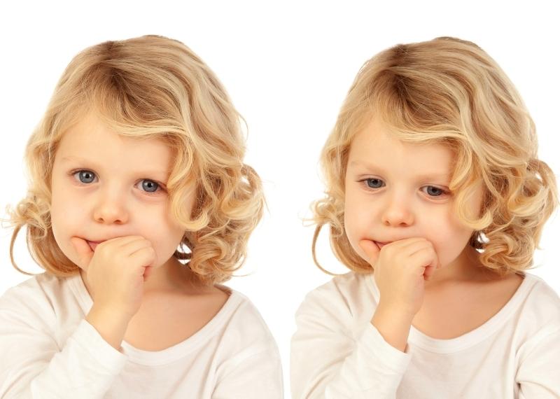 rối loạn động tác định hình