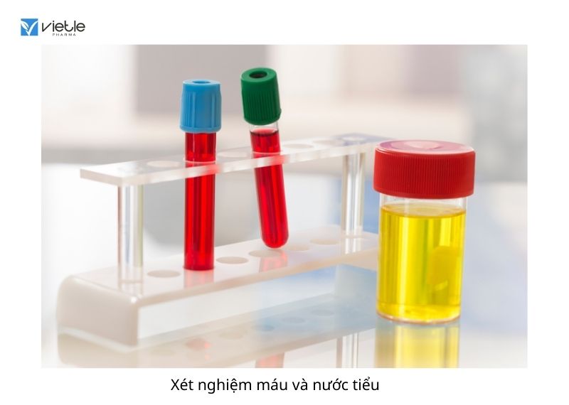 Ứ NƯỚC Ứ MỦ BỂ THẬN