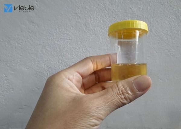 Ung thư biểu mô đường niệu trên