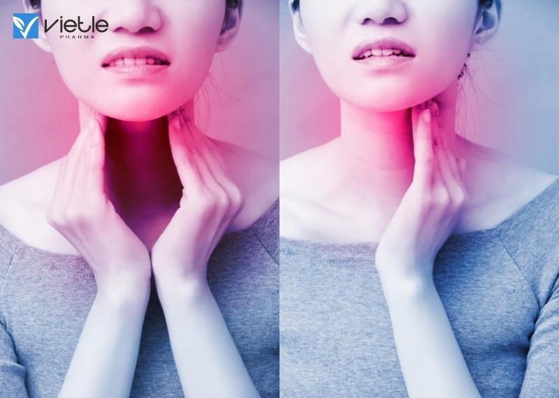 ung thư vòm mũi họng