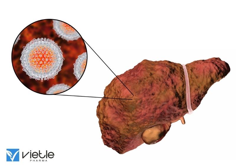 viêm gan virus c: căn bệnh đáng lo ngại