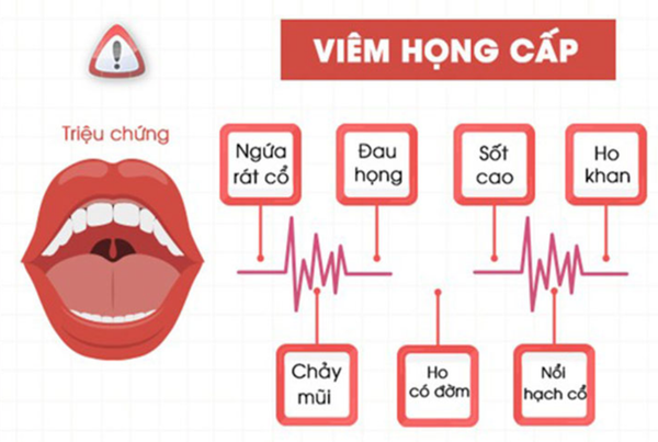 VIÊM HỌNG CẤP