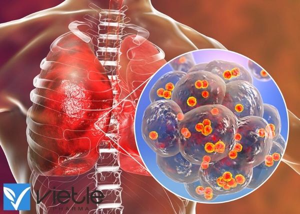 Viêm phổi không đáp ứng điều trị