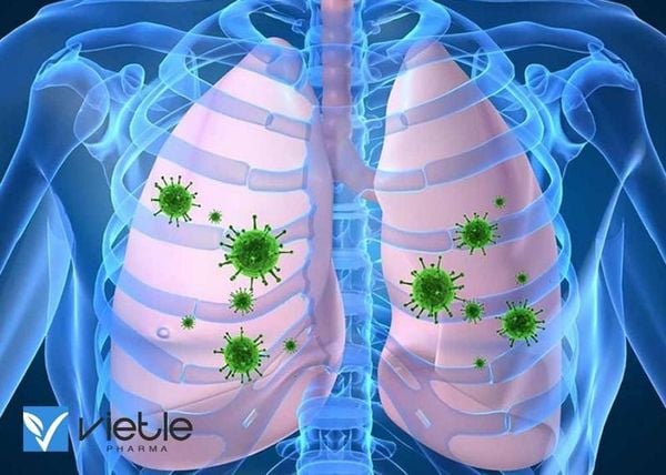 VIÊM PHỔI NẶNG DO VI KHUẨN TẠI CỘNG ĐỒNG
