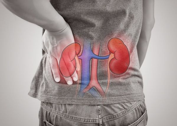 VIÊM THẬN LUPUS