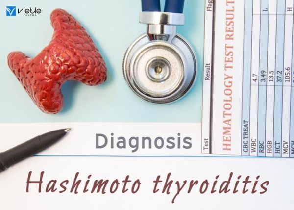 viêm tuyến giáp Hashimoto