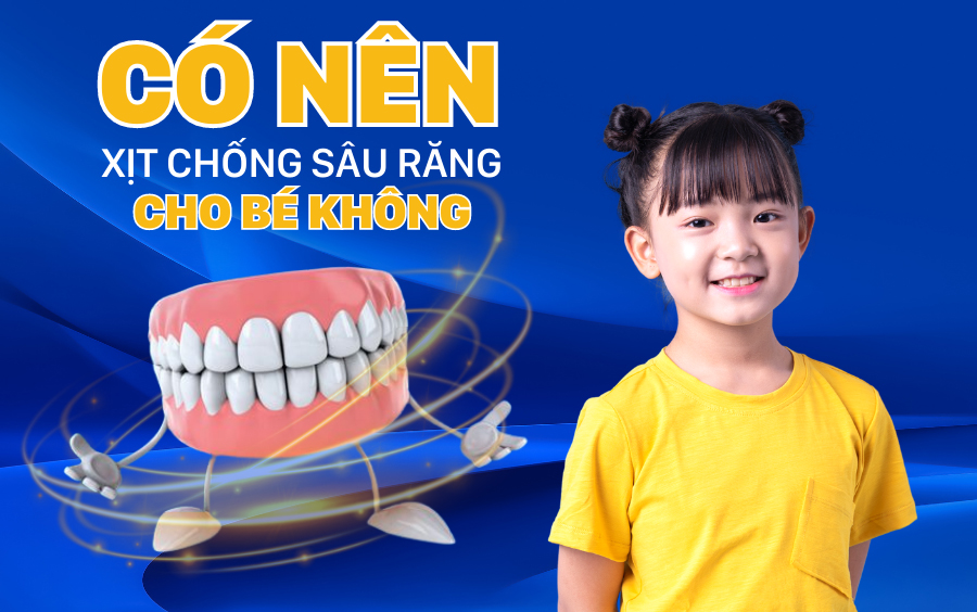 Có nên dùng xịt chống sâu răng cho bé không? Lời khuyên từ bác sĩ