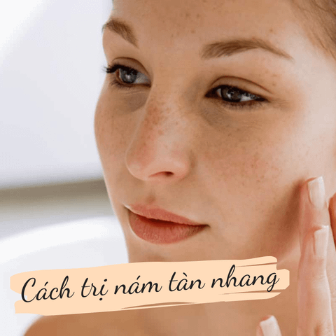 HƯỚNG DẪN CÁCH TRỊ NÁM TÀN NHANG HIỆU QUẢ