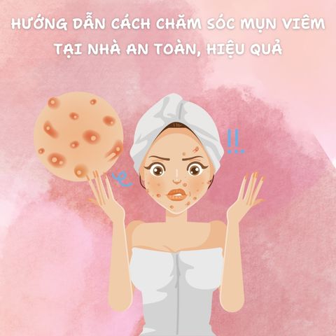HƯỚNG DẪN CÁCH CHĂM SÓC MỤN VIÊM TẠI NHÀ AN TOÀN, HIỆU QUẢ