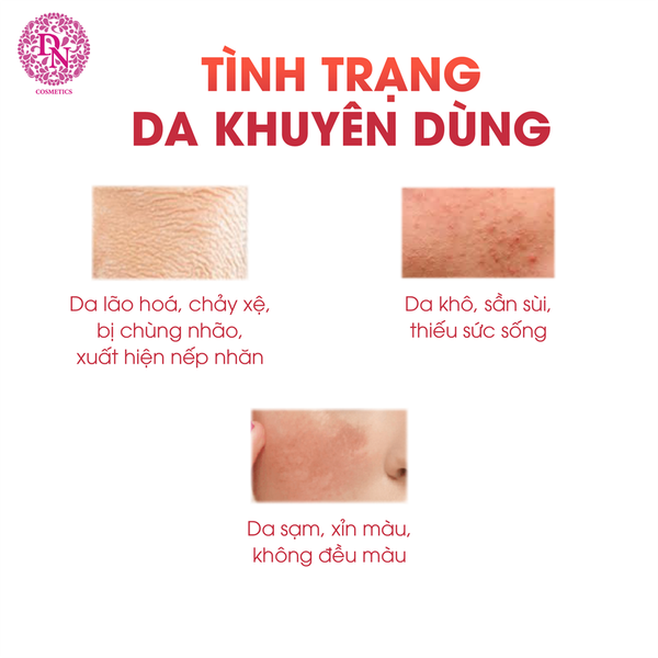 kem-duong-am-sang-da-banobagi-calming-care-moisturizing-cream-50ml