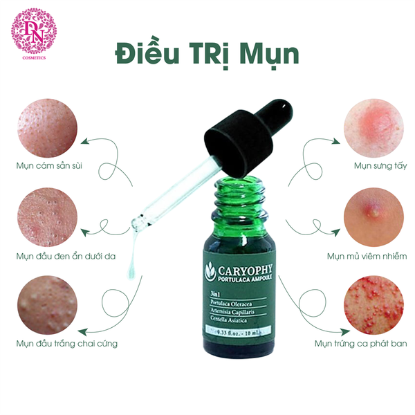 serum-tri-mun-caryophy-portulaca-ampoule-10ml-gia-ny-350k-2