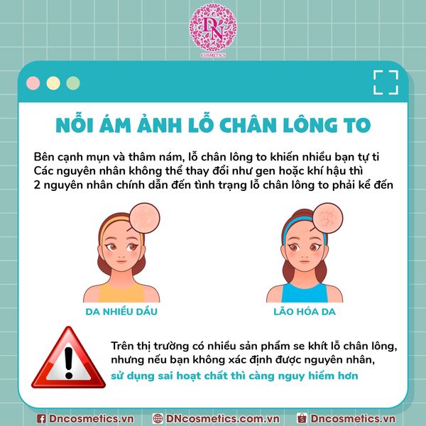 HƯỚNG DẪN XỬ LÝ LỖ CHÂN LÔNG TO CÙNG DN COSMETICS