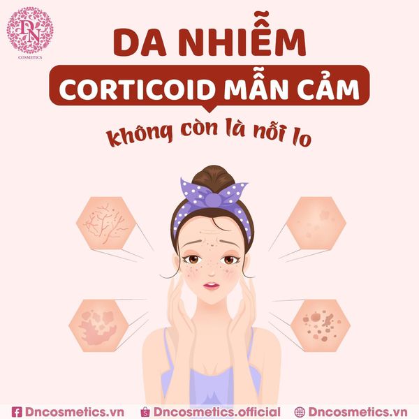 da-nhiem-corticoid-cach-phuc-hoi