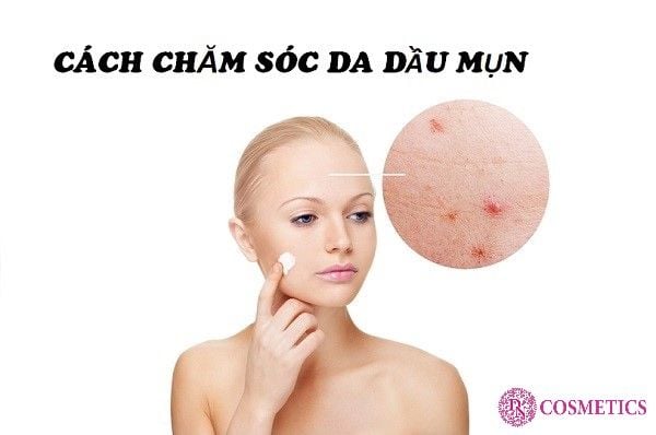 KEM DƯỠNG CHO DA DẦU MỤN