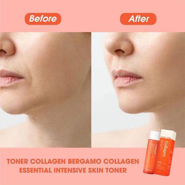 Toner Bergamo Collagen 5