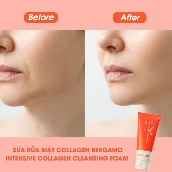 Sữa rửa mặt Bergamo Collagen 2