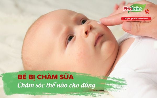 Bé bị chàm sữa: Chăm sóc thế nào cho đúng?