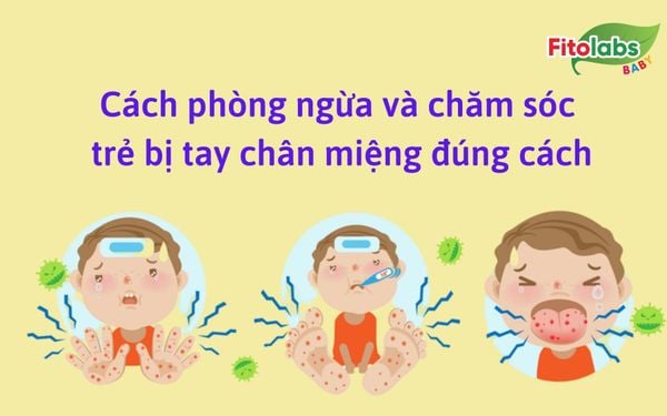 Cách phòng ngừa và chăm sóc trẻ bị tay chân miệng đúng cách | Fitolabs