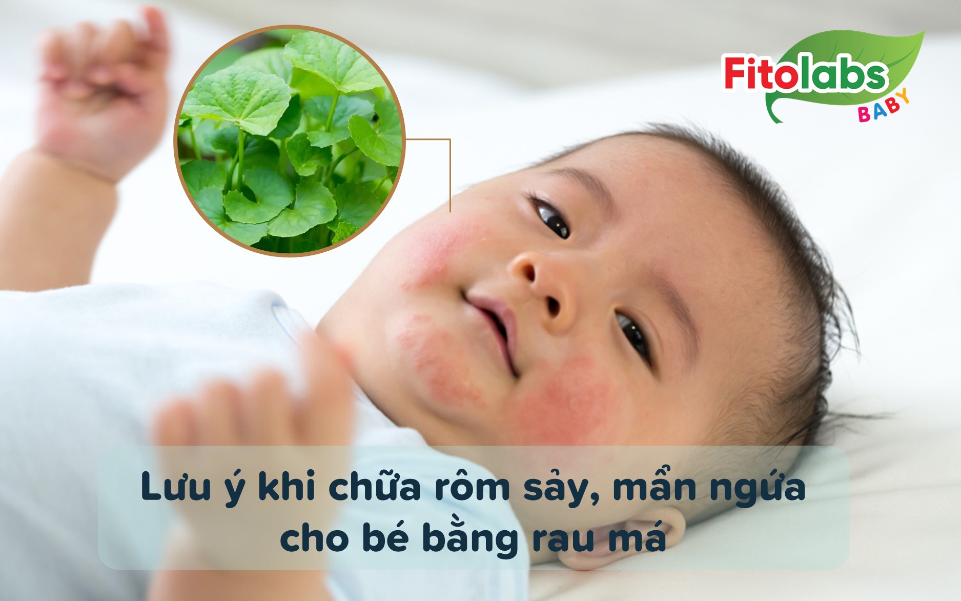 Lưu ý khi chữa rôm sảy, mẩn ngứa cho bé bằng rau má