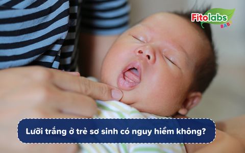 Lưỡi trắng ở trẻ sơ sinh có nguy hiểm không? | Fitolabs