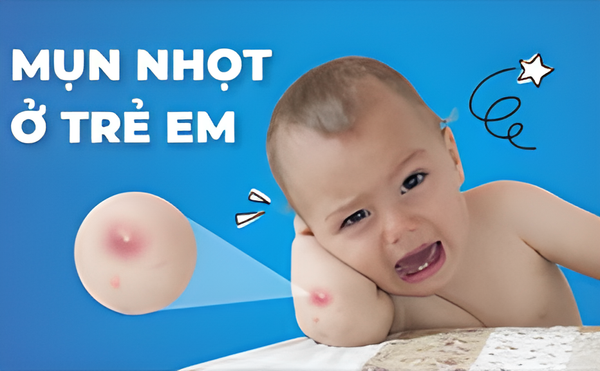 Tại sao muối tắm thảo dược Zizobii lại 