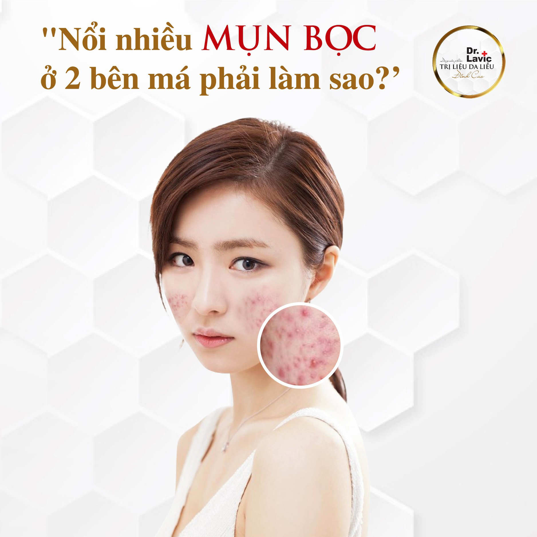 𝐍𝐎̂̉𝐈 𝐍𝐇𝐈𝐄̂̀𝐔 𝐌𝐔̣𝐍 𝐁𝐎̣𝐂 𝟐 𝐁𝐄̂𝐍 𝐌𝐀́ 𝐏𝐇𝐀̉𝐈 𝐋𝐀̀𝐌 𝐒𝐀𝐎?