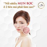 𝐍𝐎̂̉𝐈 𝐍𝐇𝐈𝐄̂̀𝐔 𝐌𝐔̣𝐍 𝐁𝐎̣𝐂 𝟐 𝐁𝐄̂𝐍 𝐌𝐀́ 𝐏𝐇𝐀̉𝐈 𝐋𝐀̀𝐌 𝐒𝐀𝐎?