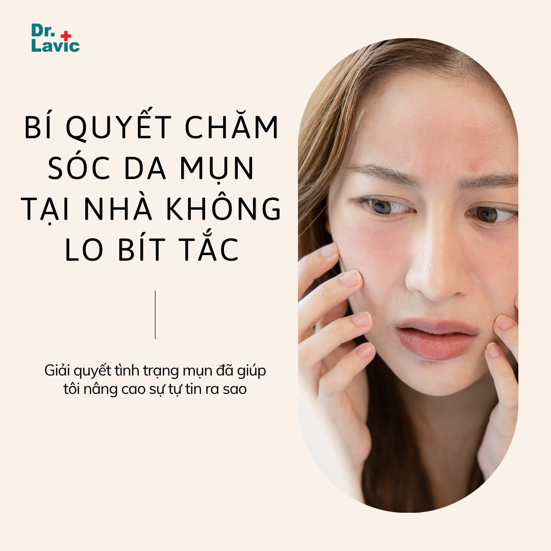 BÍ QUYẾT CHĂM SÓC DA MỤN TẠI NHÀ KHÔNG LO BÍT TẮC