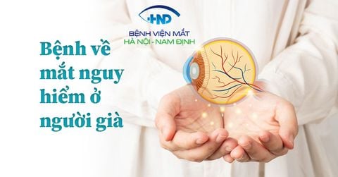 Tổng hợp các bệnh về mắt nguy hiểm ở người già