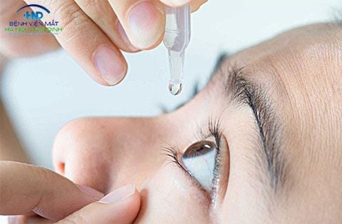 Những biện pháp khắc phục tại nhà khi bị khô mắt?