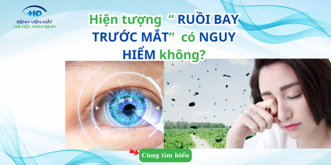 Hiện tượng Ruồi bay trước mắt là gì ? Có nguy hiểm không ?